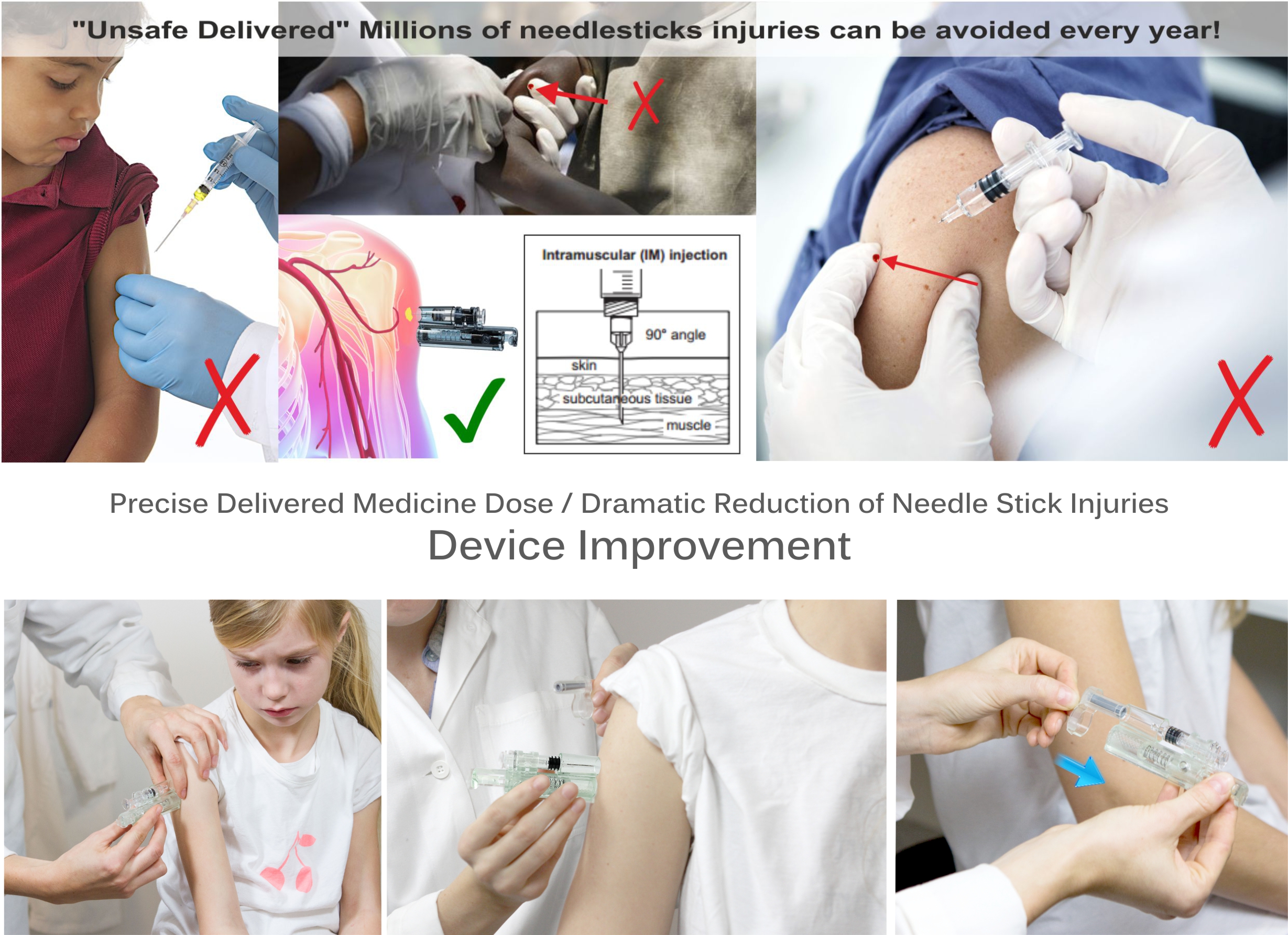 intramuscular device